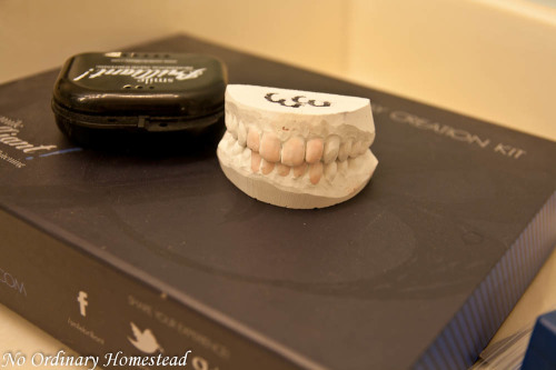 diy-teeth-whitening-mold